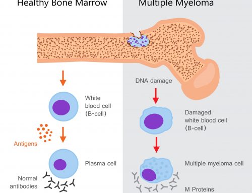 Multiple Myeloma
